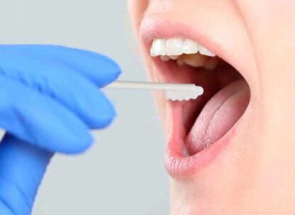 Buccal Cell Mouth Swab